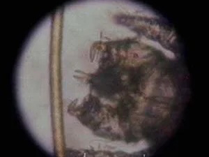Cheyletiella mite microscope view in Lacey