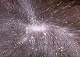 Close-up of a dog's coat showing dandruff and mite debris caused by cheyletiellosis at a veterinary dermatology clinic in Lacey