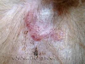 Close-up of a dog's skin showing a sterile granuloma lesion at a veterinary dermatology clinic in Lacey