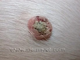 Close-up of a single raised viral papilloma wart on a dog's skin in Lacey